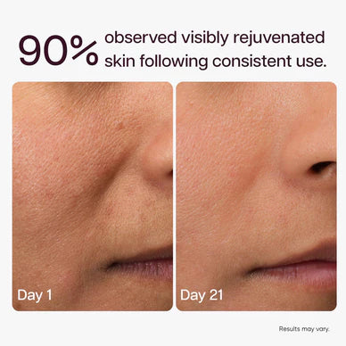 Ultracleanse™ 6-in-1 LED Facial Wand